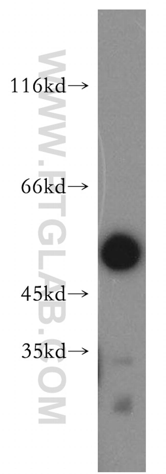 ATF4 Antibody in Western Blot (WB)