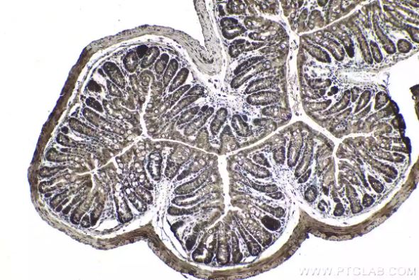 ATF4 Antibody in Immunohistochemistry (Paraffin) (IHC (P))