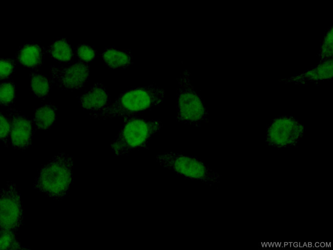 Histone H2A.X Antibody in Immunocytochemistry (ICC/IF)