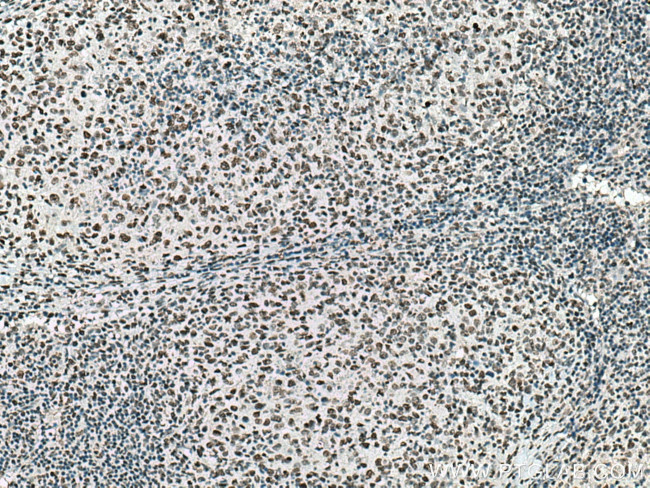 Histone H2A.X Antibody in Immunohistochemistry (Paraffin) (IHC (P))