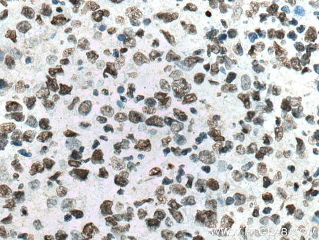 Histone H2A.X Antibody in Immunohistochemistry (Paraffin) (IHC (P))