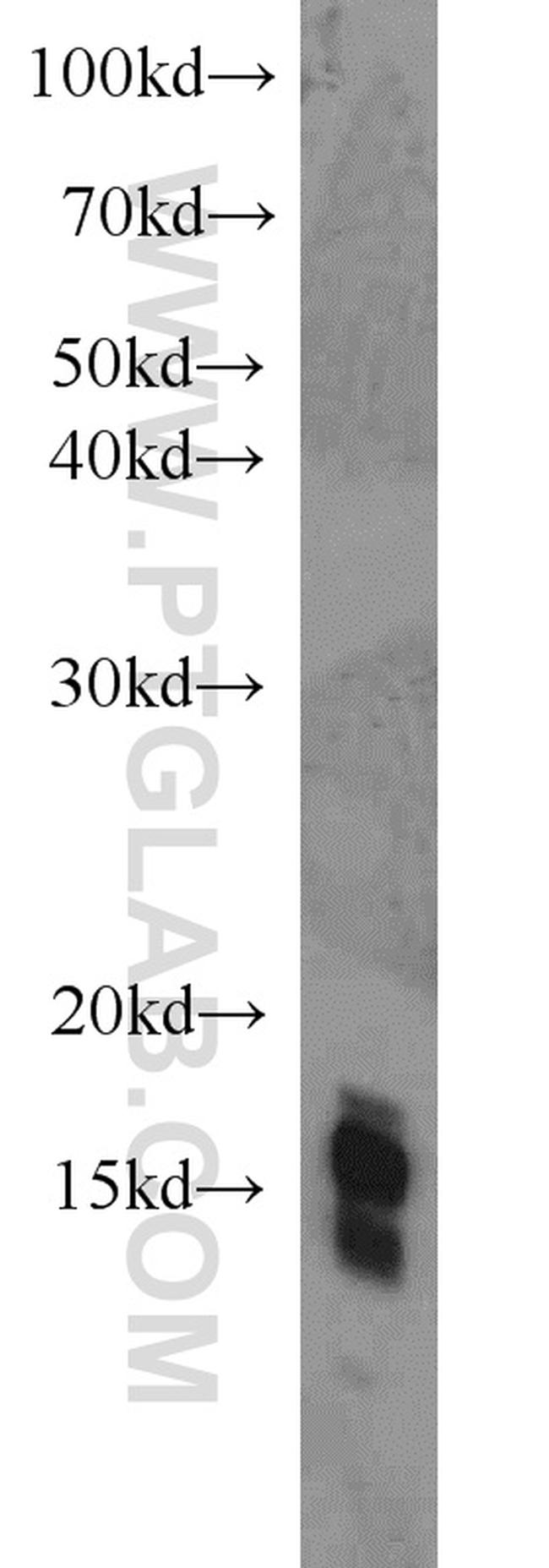 Histone H2A.X Antibody in Western Blot (WB)