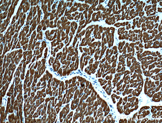 Myosin Light Chain 2 Antibody in Immunohistochemistry (Paraffin) (IHC (P))