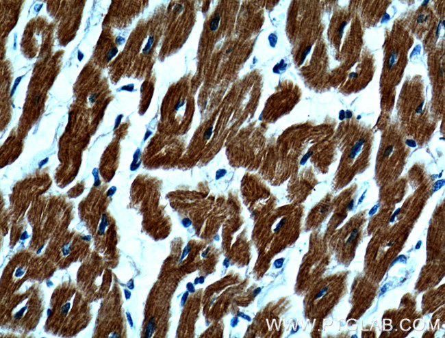 Myosin Light Chain 2 Antibody in Immunohistochemistry (Paraffin) (IHC (P))