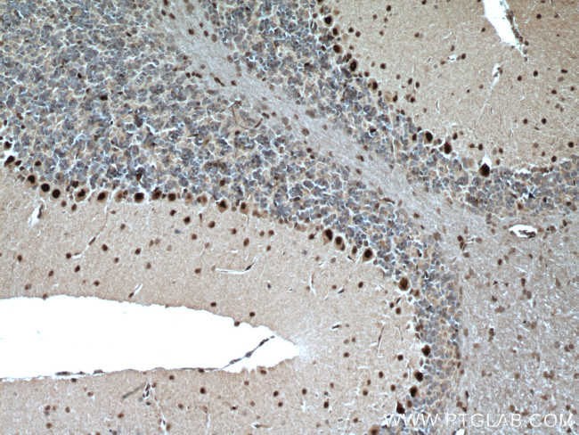 DACH1 Antibody in Immunohistochemistry (Paraffin) (IHC (P))