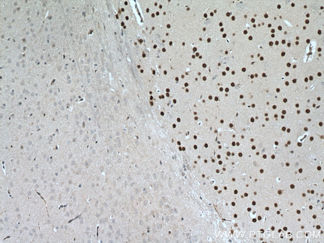 DACH1 Antibody in Immunohistochemistry (Paraffin) (IHC (P))