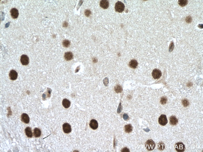 DACH1 Antibody in Immunohistochemistry (Paraffin) (IHC (P))