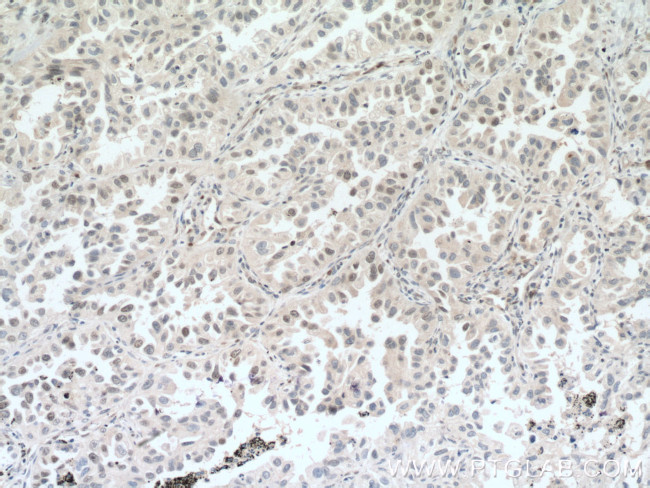 DACH1 Antibody in Immunohistochemistry (Paraffin) (IHC (P))