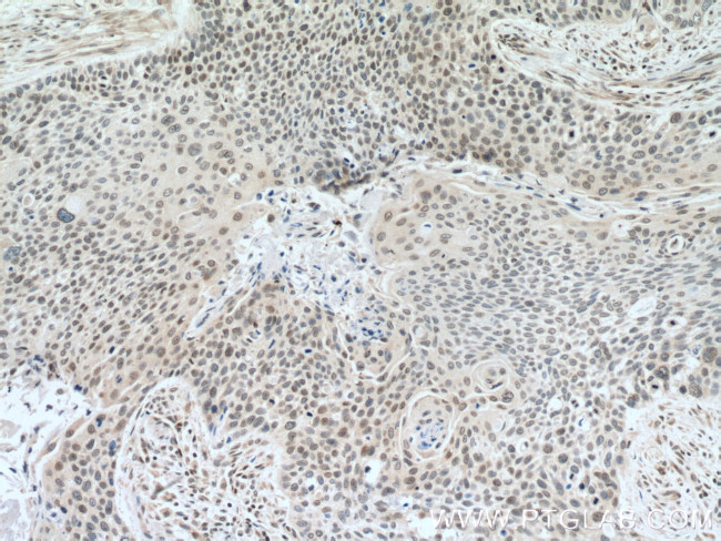 DACH1 Antibody in Immunohistochemistry (Paraffin) (IHC (P))