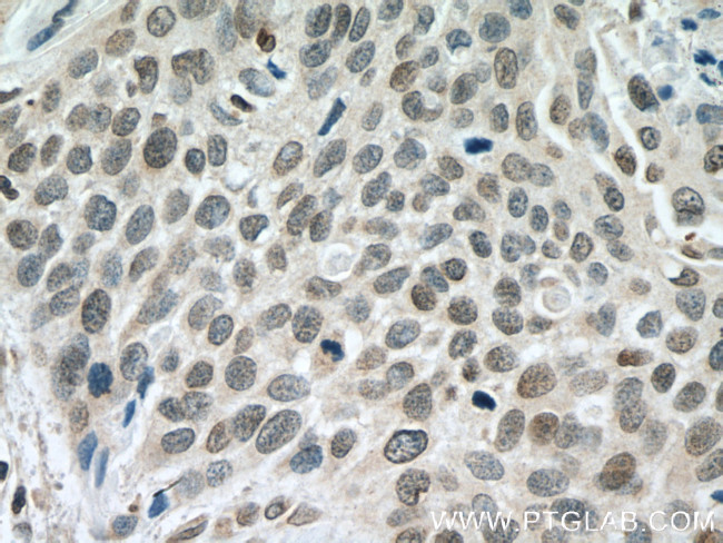 DACH1 Antibody in Immunohistochemistry (Paraffin) (IHC (P))