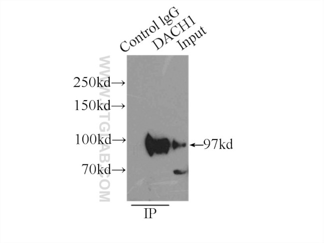 DACH1 Antibody in Immunoprecipitation (IP)