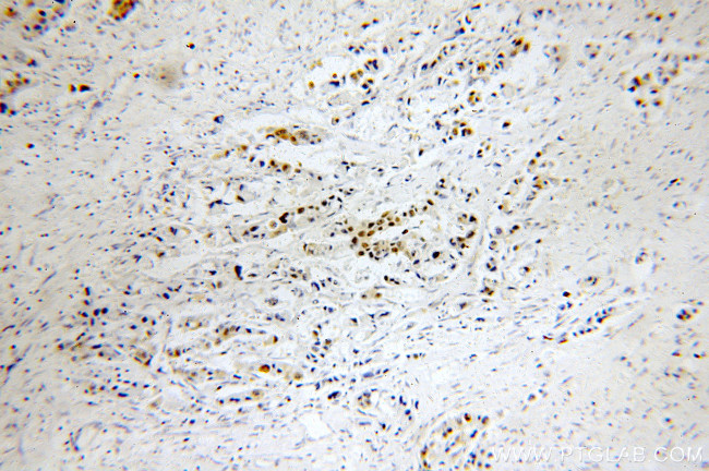 HSP70 Antibody in Immunohistochemistry (Paraffin) (IHC (P))