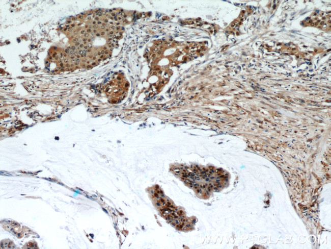 HSP70 Antibody in Immunohistochemistry (Paraffin) (IHC (P))