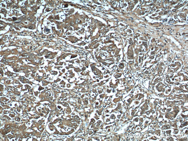 HSP70 Antibody in Immunohistochemistry (Paraffin) (IHC (P))