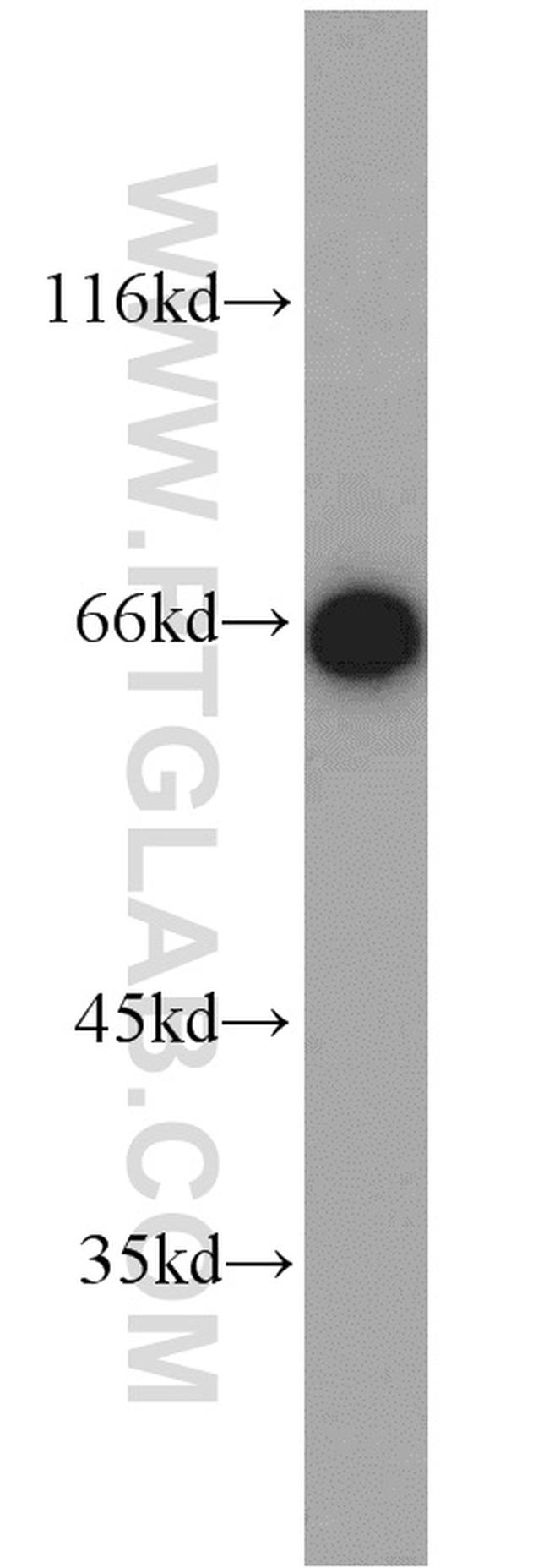 HSP70 Antibody in Western Blot (WB)