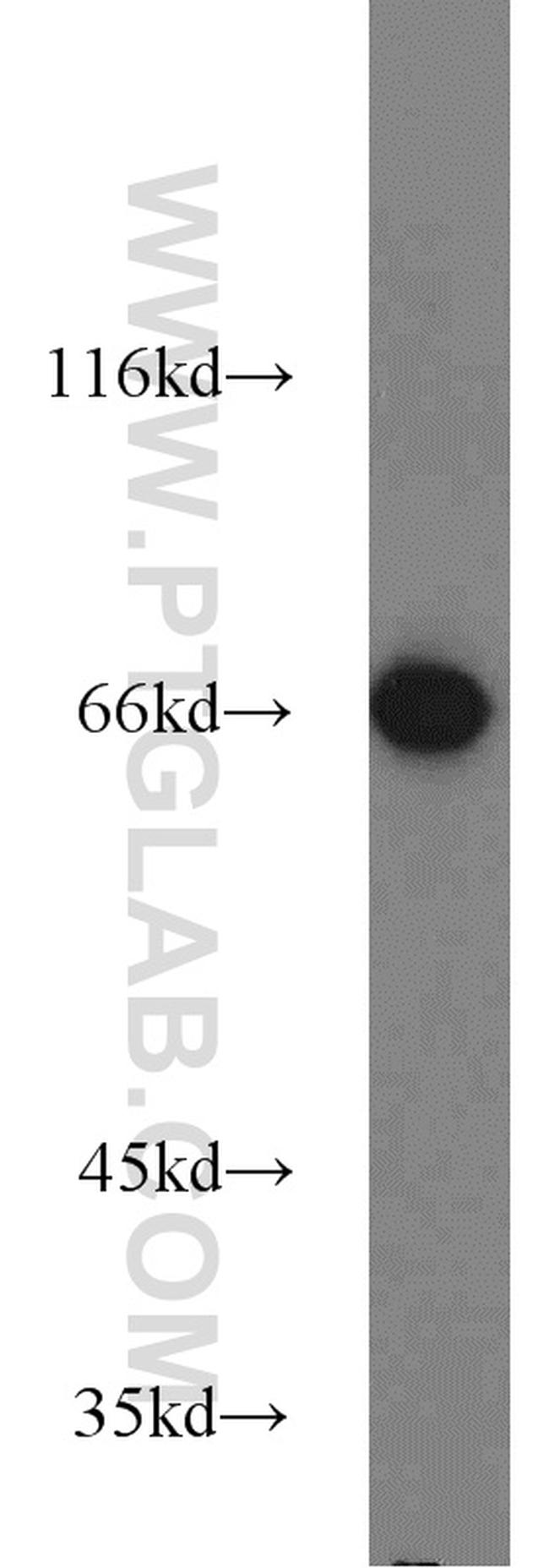 HSP70 Antibody in Western Blot (WB)