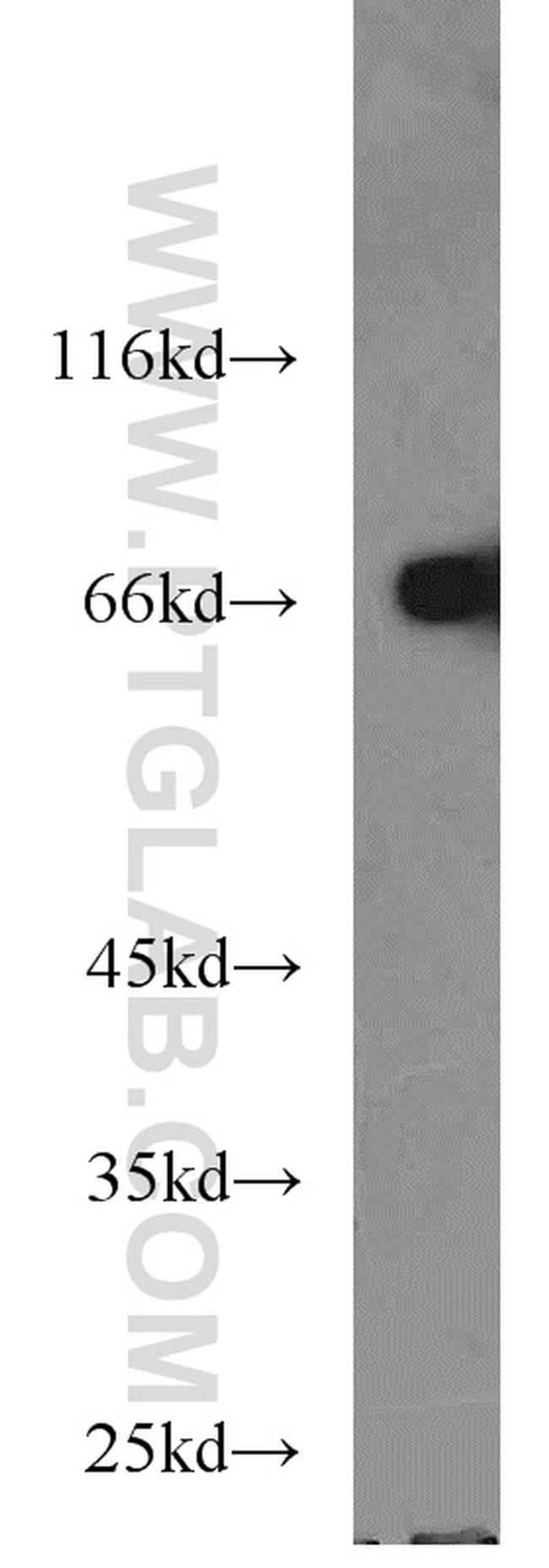 HSP70 Antibody in Western Blot (WB)