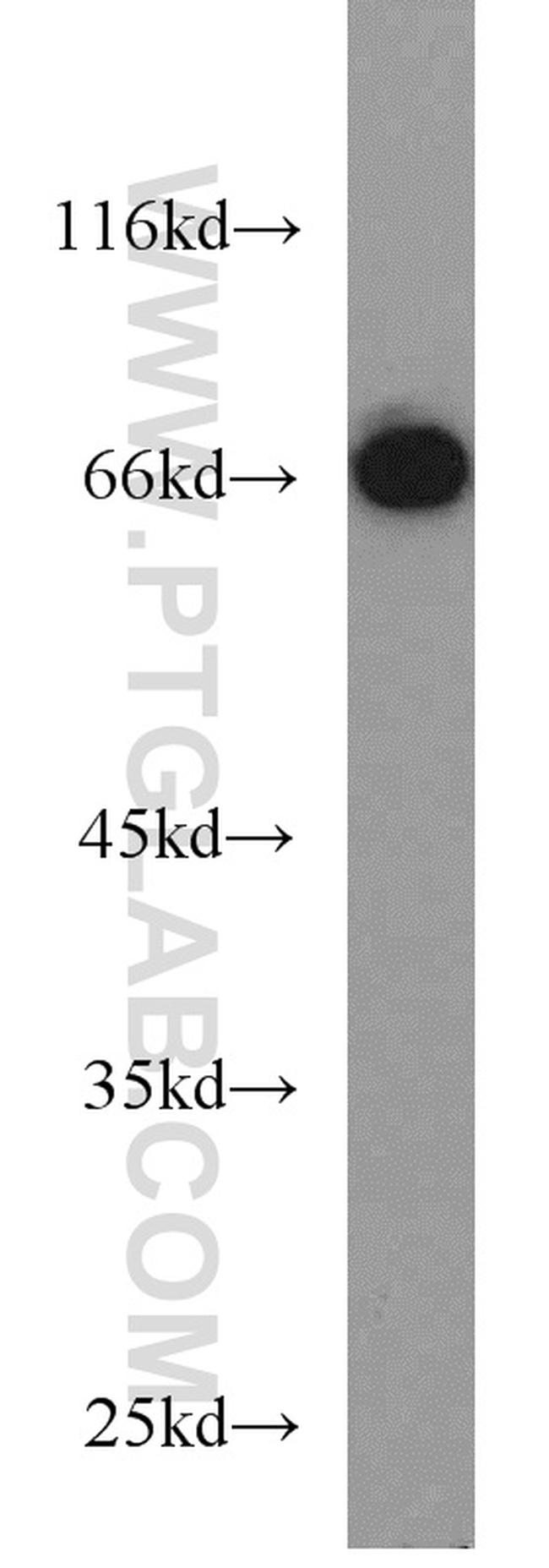 HSP70 Antibody in Western Blot (WB)