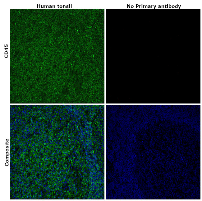 CD45 Antibody in Immunohistochemistry (Paraffin) (IHC (P))