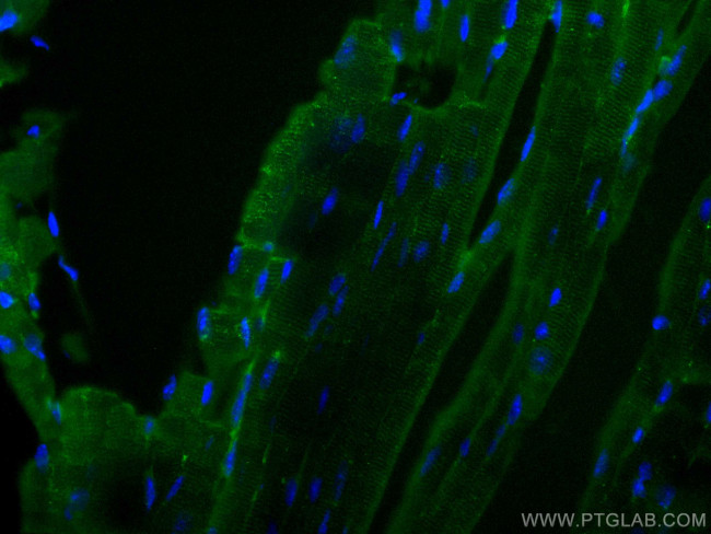 Beclin 1 Antibody in Immunohistochemistry (PFA fixed) (IHC (PFA))