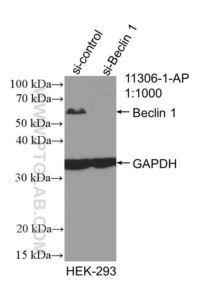 Beclin 1 Antibody in Western Blot (WB)