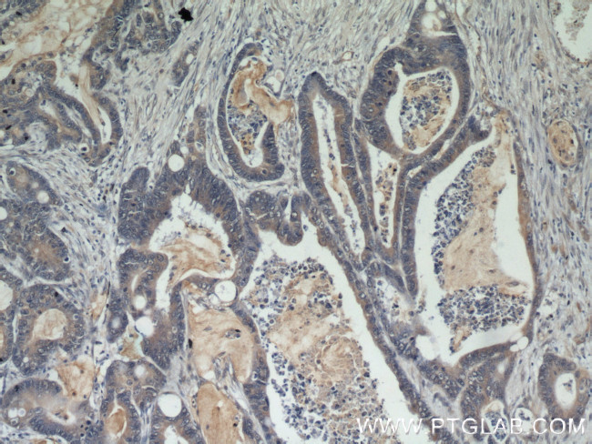 Beclin 1 Antibody in Immunohistochemistry (Paraffin) (IHC (P))