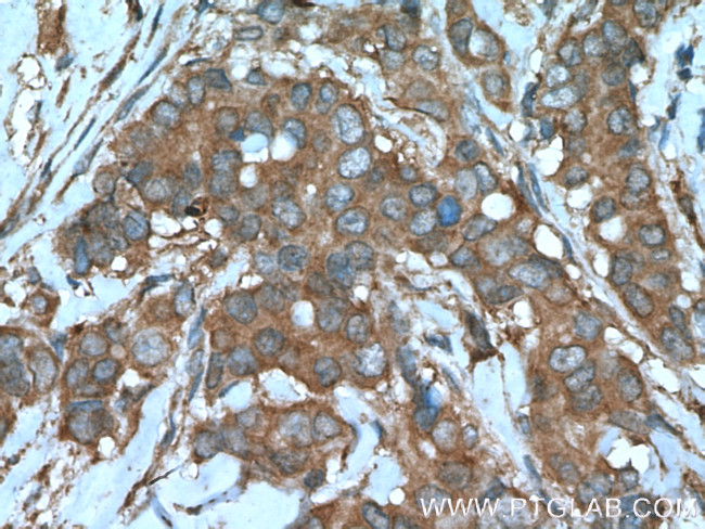 Beclin 1 Antibody in Immunohistochemistry (Paraffin) (IHC (P))