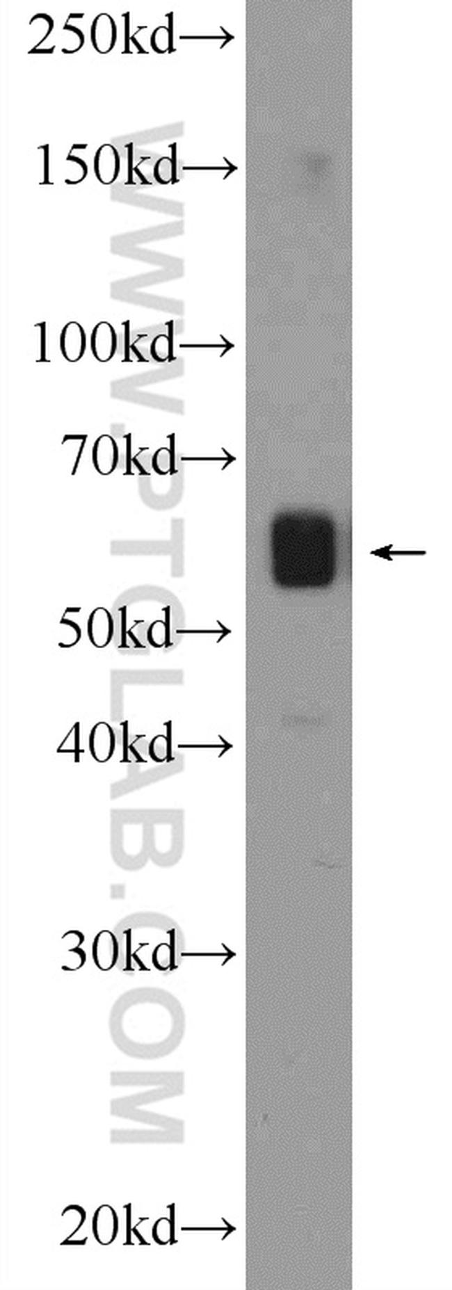 Beclin 1 Antibody in Western Blot (WB)