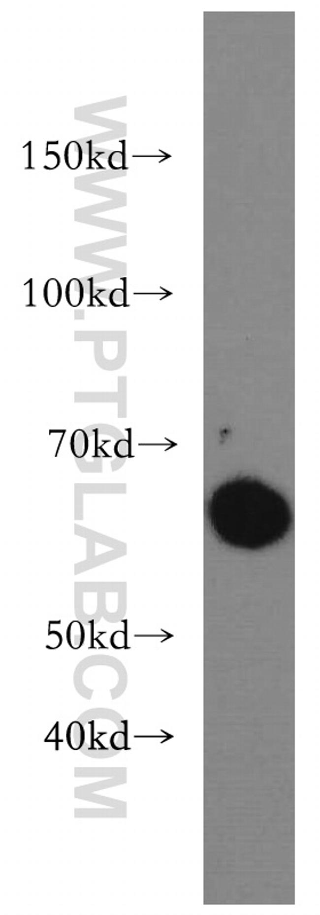 Beclin 1 Antibody in Western Blot (WB)