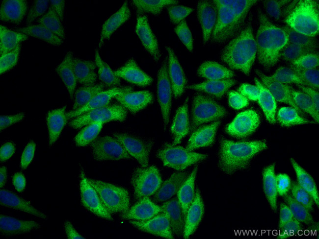 NQO1 Antibody in Immunocytochemistry (ICC/IF)