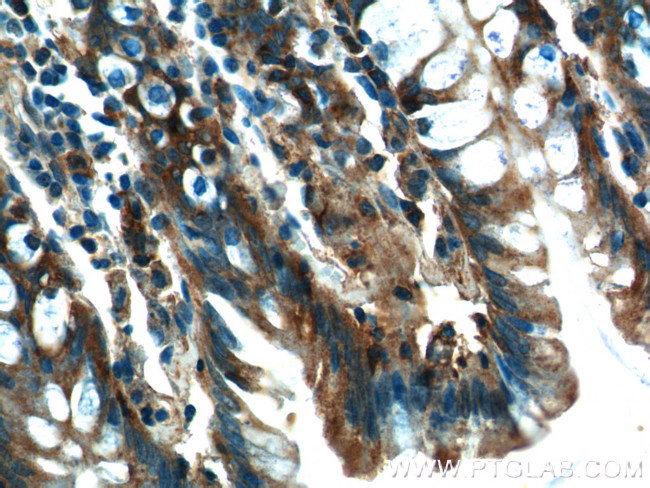 NQO1 Antibody in Immunohistochemistry (Paraffin) (IHC (P))