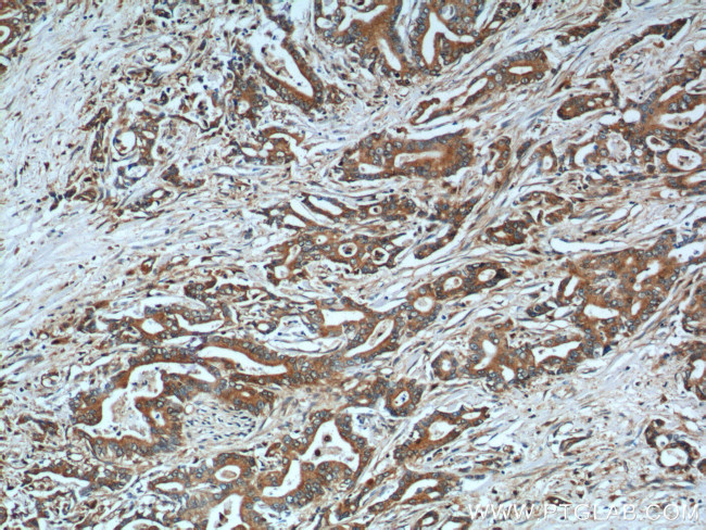 NQO1 Antibody in Immunohistochemistry (Paraffin) (IHC (P))