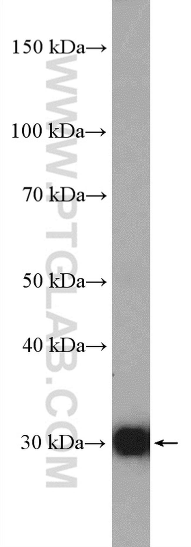 NQO1 Antibody in Western Blot (WB)