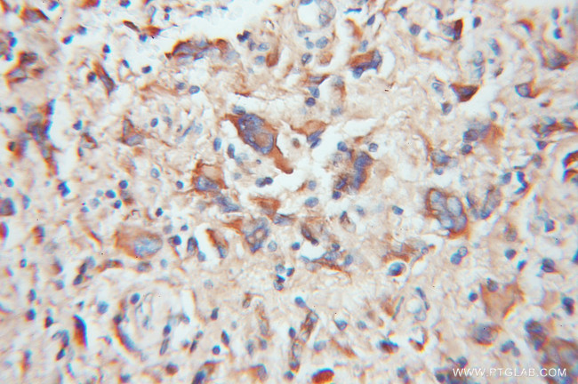 TOM20 Antibody in Immunohistochemistry (Paraffin) (IHC (P))