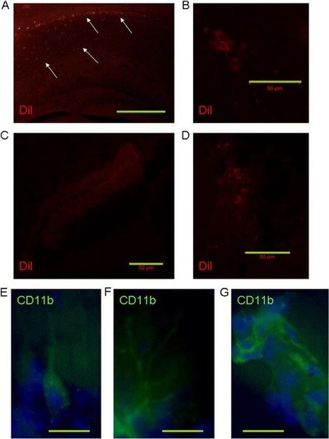 CD11b Antibody in Immunohistochemistry (IHC)