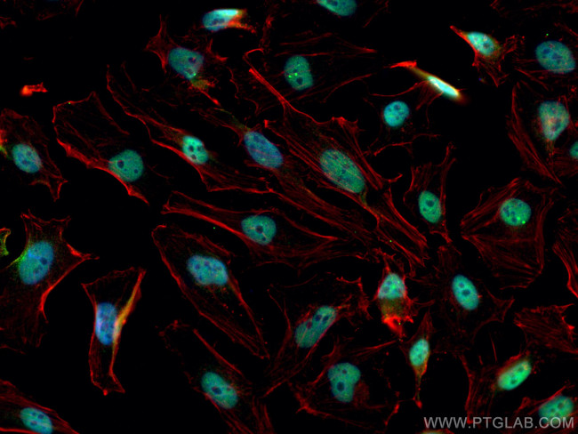 CREB1 Antibody in Immunocytochemistry (ICC/IF)