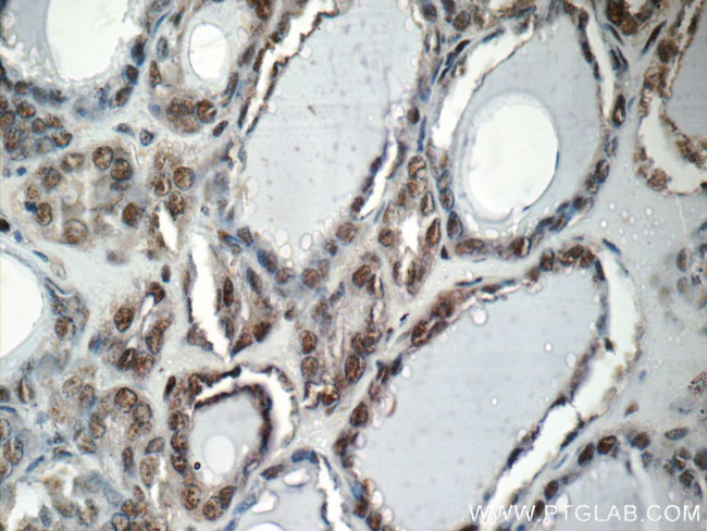 CREB1 Antibody in Immunohistochemistry (Paraffin) (IHC (P))