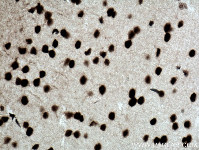 CREB1 Antibody in Immunohistochemistry (Paraffin) (IHC (P))