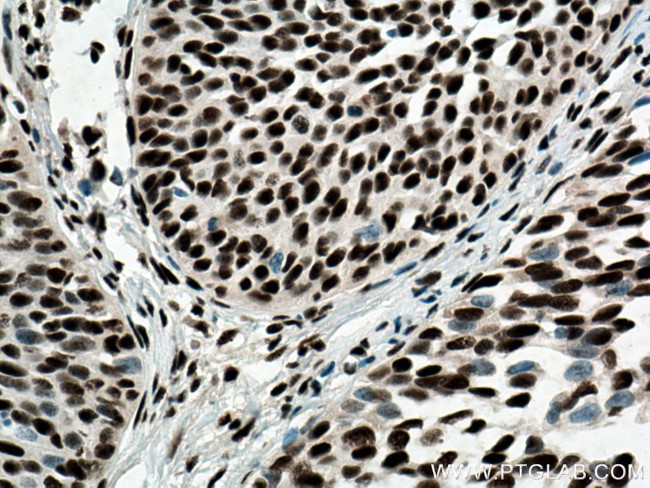 CREB1 Antibody in Immunohistochemistry (Paraffin) (IHC (P))