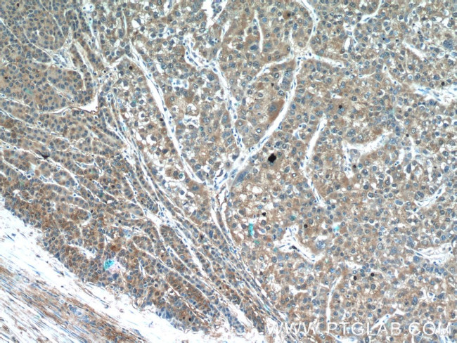 IDH1 Antibody in Immunohistochemistry (Paraffin) (IHC (P))