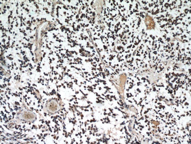 IDH1 Antibody in Immunohistochemistry (Paraffin) (IHC (P))