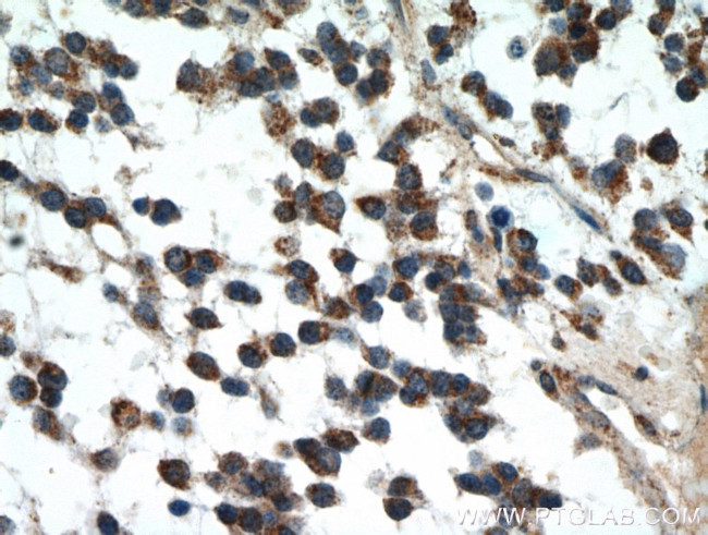 IDH1 Antibody in Immunohistochemistry (Paraffin) (IHC (P))