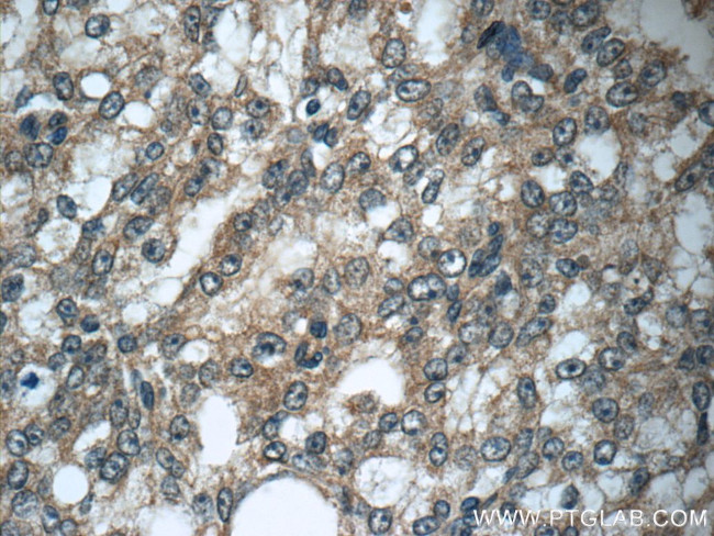 GAGE7 Antibody in Immunohistochemistry (Paraffin) (IHC (P))