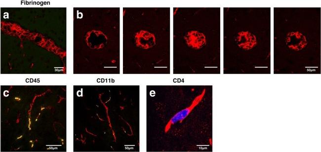 CD11b Antibody in Immunohistochemistry (IHC)