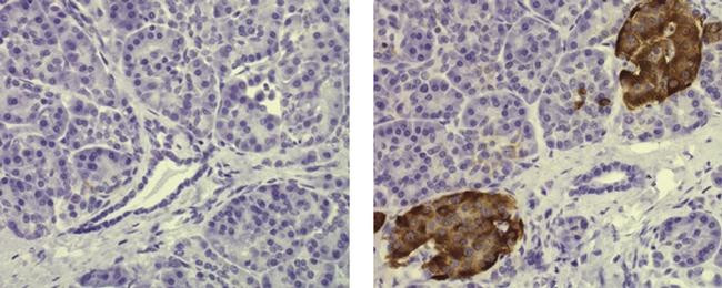 Mouse IgG2a kappa Isotype Control in Immunohistochemistry (Paraffin) (IHC (P))