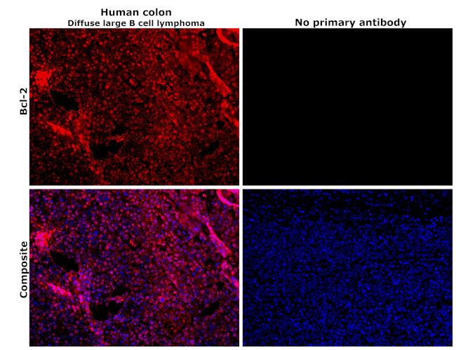 Bcl-2 Antibody in Immunohistochemistry (Paraffin) (IHC (P))