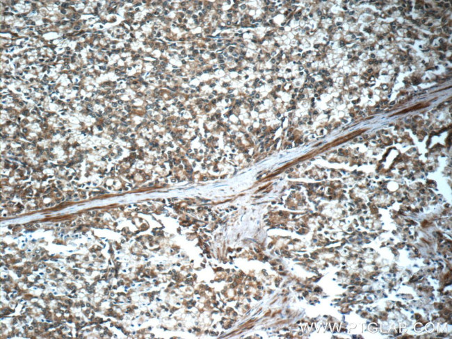 FAS/CD95 Antibody in Immunohistochemistry (Paraffin) (IHC (P))