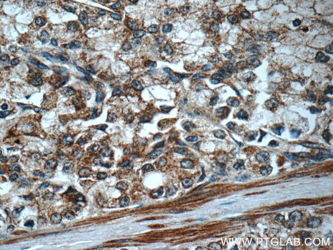 FAS/CD95 Antibody in Immunohistochemistry (Paraffin) (IHC (P))