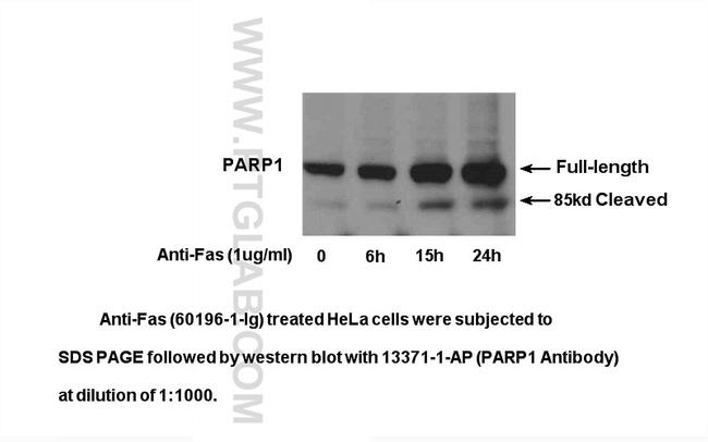 PARP1 Antibody in Western Blot (WB)