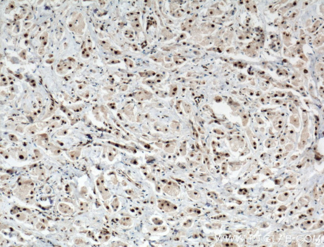 PARP1 Antibody in Immunohistochemistry (Paraffin) (IHC (P))